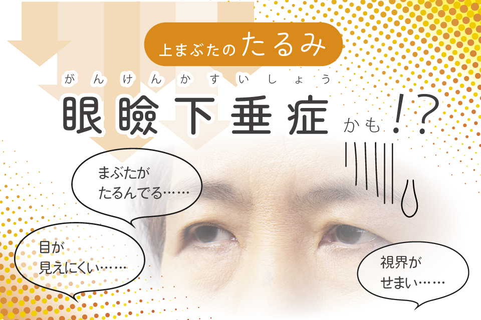 上まぶたのたるみ 眼瞼下垂症かも⁉
